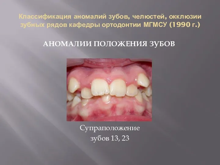Классификация аномалий зубов, челюстей, окклюзии зубных рядов кафедры ортодонтии МГМСУ