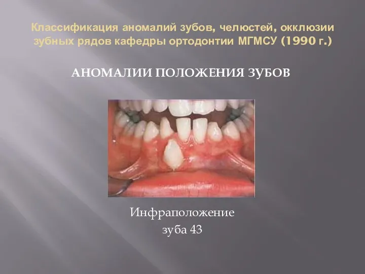 Классификация аномалий зубов, челюстей, окклюзии зубных рядов кафедры ортодонтии МГМСУ (1990 г.) АНОМАЛИИ