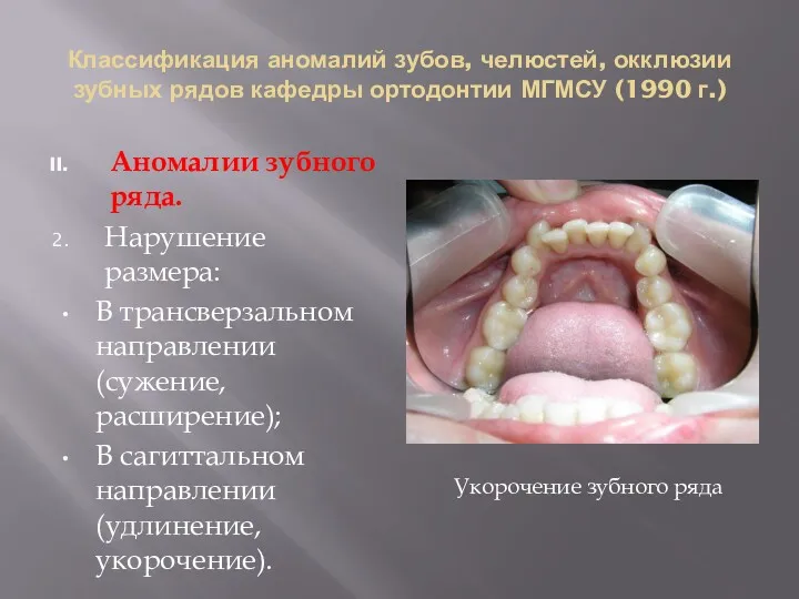 Классификация аномалий зубов, челюстей, окклюзии зубных рядов кафедры ортодонтии МГМСУ (1990 г.) Аномалии