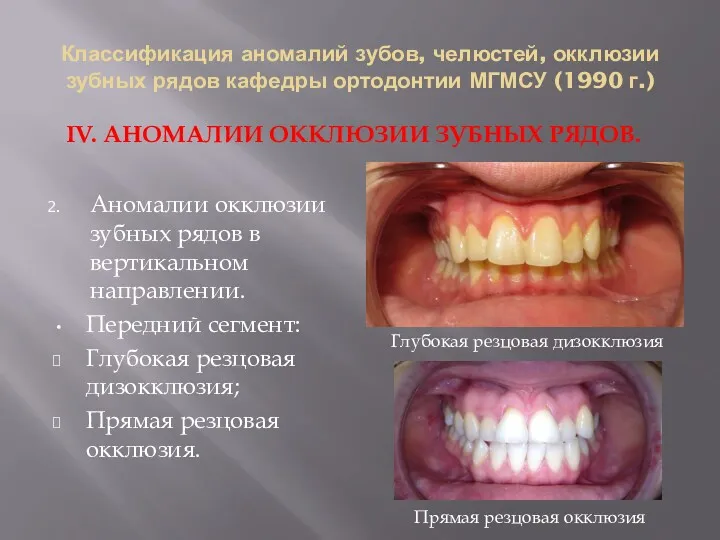 Классификация аномалий зубов, челюстей, окклюзии зубных рядов кафедры ортодонтии МГМСУ