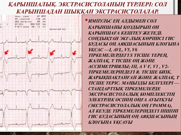 ИМПУЛЬС ЕҢ АЛДЫМЕН СОЛ ҚАРЫНШАНЫ ҚОЗДЫРЫП ОН ҚАРЫНШАҒА КЕШТЕУ ЖЕТЕДІ.