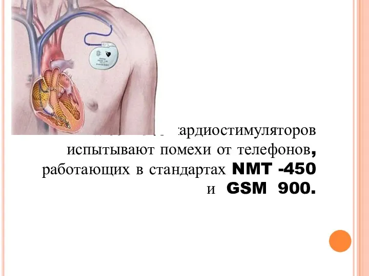 Более 30% кардиостимуляторов испытывают помехи от телефонов, работающих в стандартах NMT -450 и GSM 900.