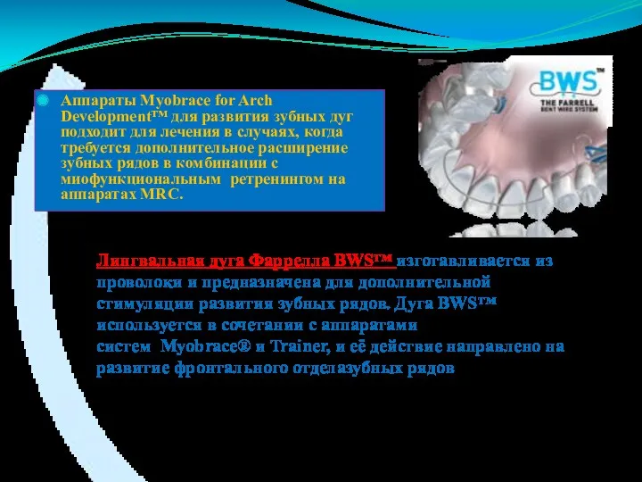 Аппараты Myobrace for Arch Development™ для развития зубных дуг подходит
