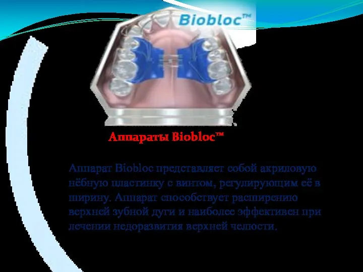 Аппарат Biobloc представляет собой акриловую нёбную пластинку с винтом, регулирующим