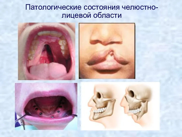 Патологические состояния челюстно-лицевой области