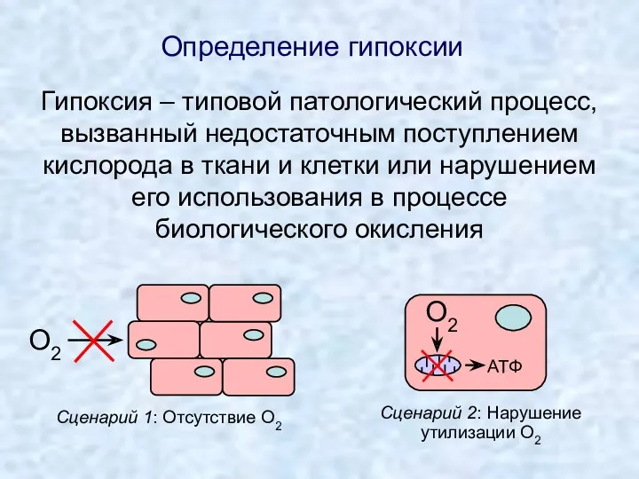 Гипоксия – типовой патологический процесс, вызванный недостаточным поступлением кислорода в