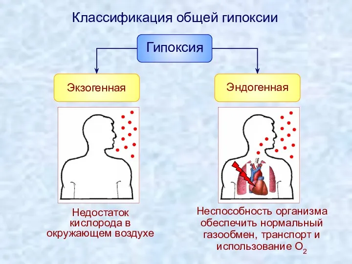 Экзогенная Недостаток кислорода в окружающем воздухе Классификация общей гипоксии Неспособность