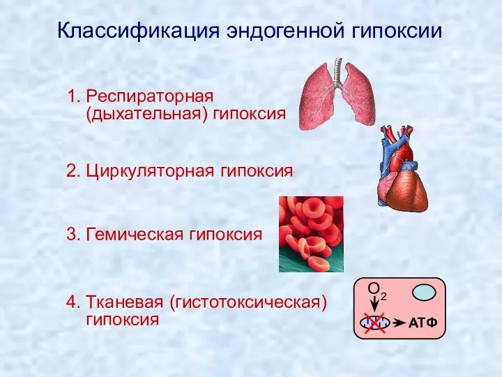 Классификация эндогенной гипоксии 1. Респираторная (дыхательная) гипоксия 2. Циркуляторная гипоксия