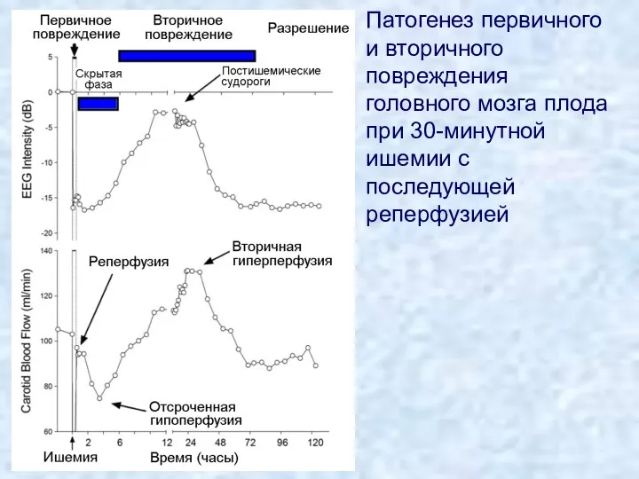 Патогенез первичного и вторичного повреждения головного мозга плода при 30-минутной ишемии с последующей реперфузией