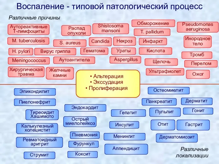 Альтерация Экссудация Пролиферация Воспаление - типовой патологический процесс