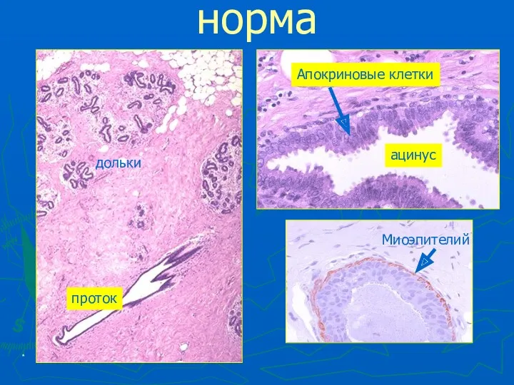 * норма дольки проток Миоэпителий Апокриновые клетки ацинус