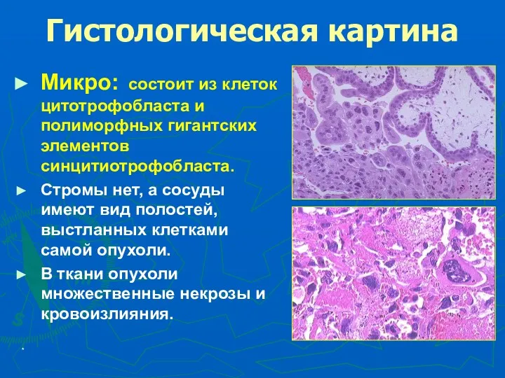 * Гистологическая картина Микро: состоит из клеток цитотрофобласта и полиморфных