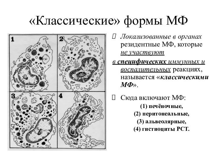 «Классические» формы МФ Локализованные в органах резидентные МФ, которые не