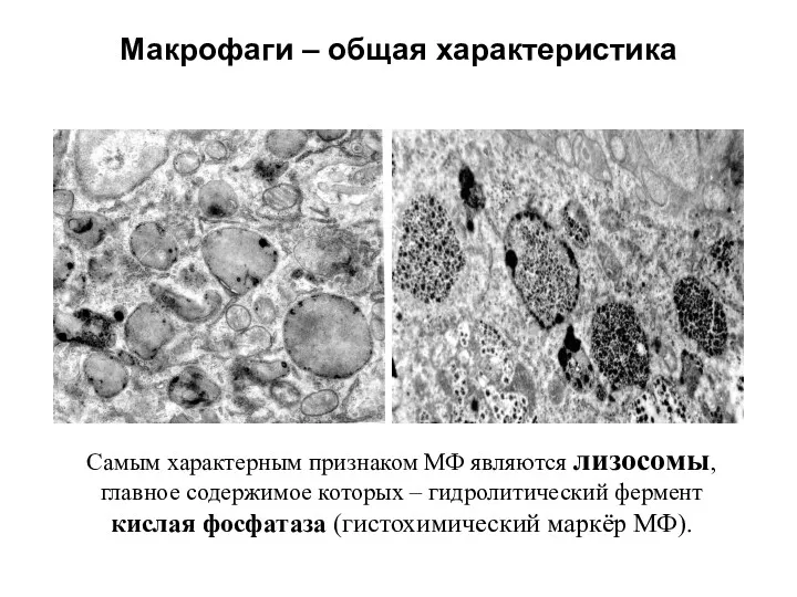 Макрофаги – общая характеристика Самым характерным признаком МФ являются лизосомы,