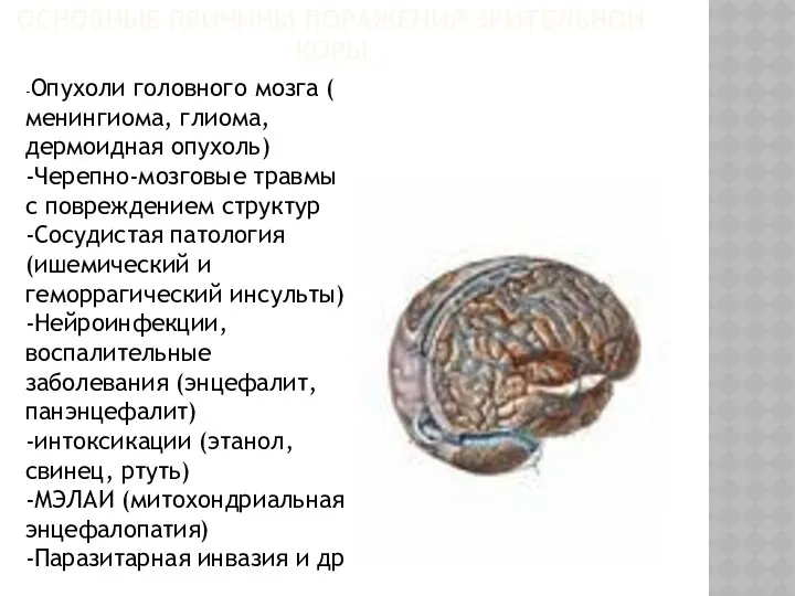 ОСНОВНЫЕ ПРИЧИНЫ ПОРАЖЕНИЯ ЗРИТЕЛЬНОЙ КОРЫ -Опухоли головного мозга ( менингиома,