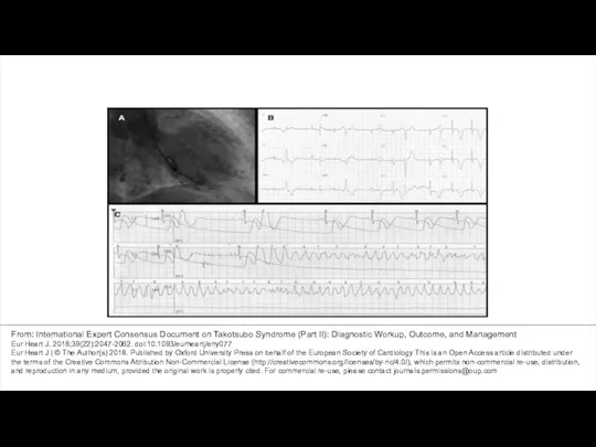 From: International Expert Consensus Document on Takotsubo Syndrome (Part II):