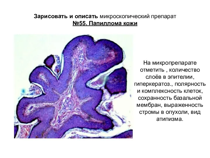 Зарисовать и описать микроскопический препарат №55. Папиллома кожи На микропрепарате отметить , количество