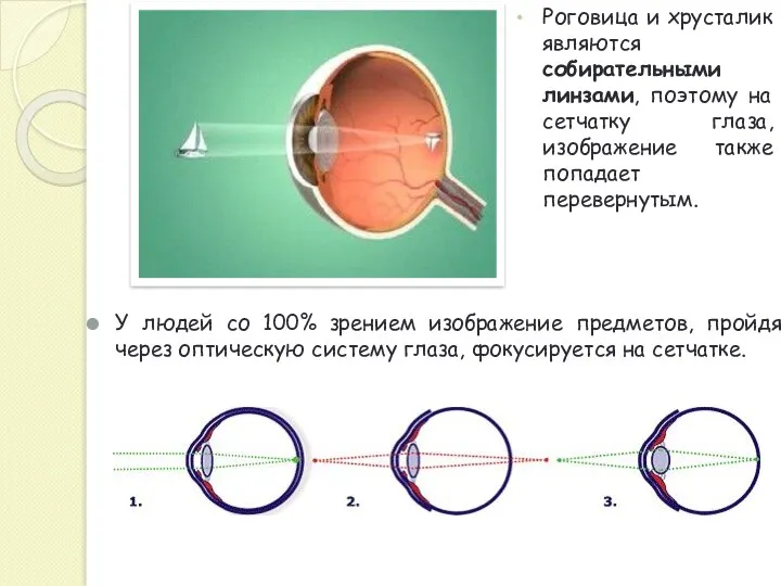 У людей со 100% зрением изображение предметов, пройдя через оптическую