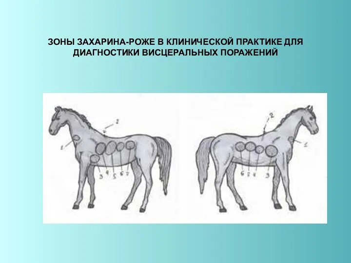 ЗОНЫ ЗАХАРИНА-РОЖЕ В КЛИНИЧЕСКОЙ ПРАКТИКЕ ДЛЯ ДИАГНОСТИКИ ВИСЦЕРАЛЬНЫХ ПОРАЖЕНИЙ