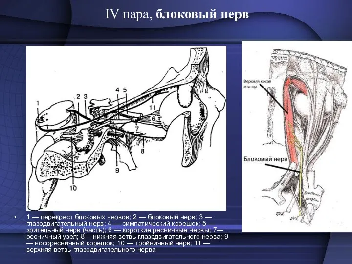 IV пара, блоковый нерв 1 — перекрест блоковых нервов; 2