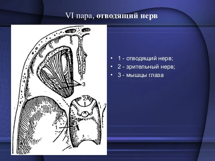 VI пара, отводящий нерв 1 - отводящий нерв; 2 - зрительный нерв; 3 - мышцы глаза