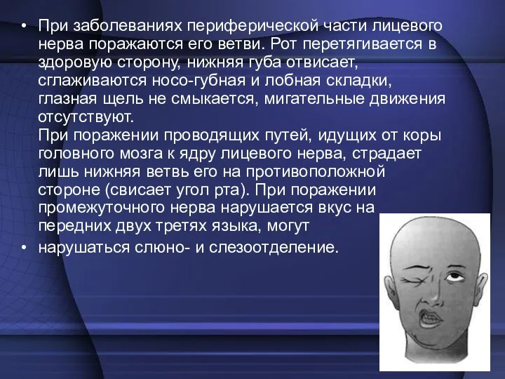 При заболеваниях периферической части лицевого нерва поражаются его ветви. Рот