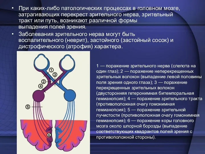 При каких-либо патологических процессах в головном мозге, затрагивающих перекрест зрительного