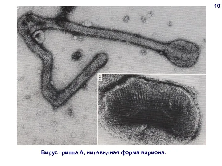 Вирус гриппа А, нитевидная форма вириона. 10