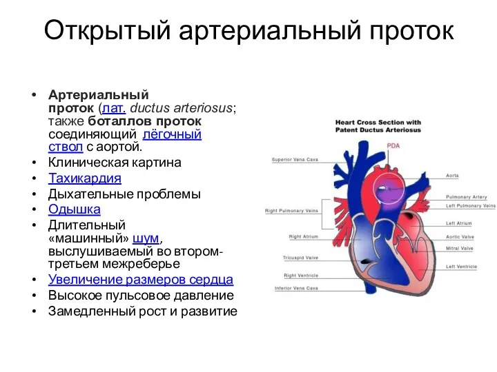 Открытый артериальный проток Артериальный проток (лат. ductus arteriosus; также боталлов