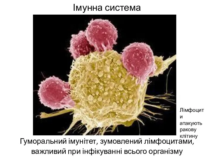 Імунна система Гуморальний імунітет, зумовлений лімфоцитами, важливий при інфікуванні всього організму Лімфоцити атакують ракову клітину