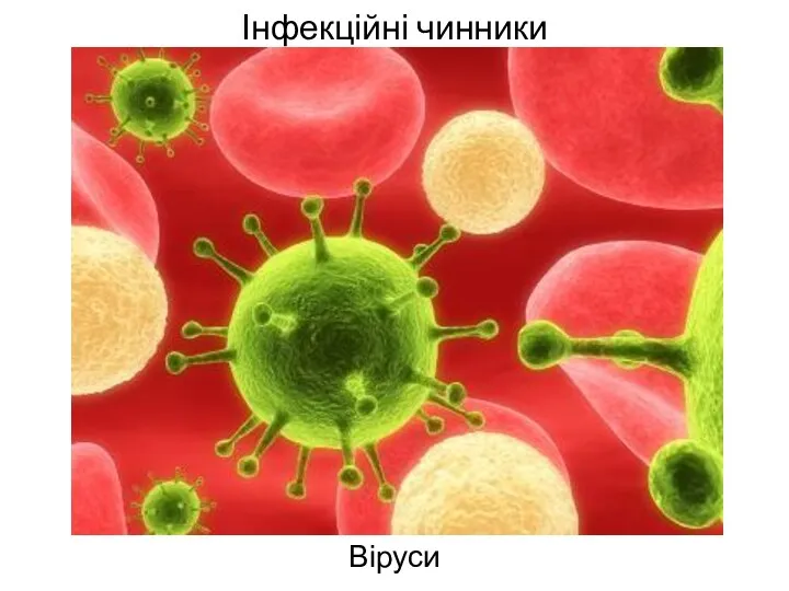 Інфекційні чинники Віруси