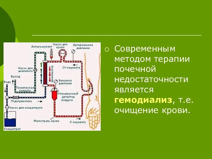 Современным методом терапии почечной недостаточности является гемодиализ, т.е. очищение крови.