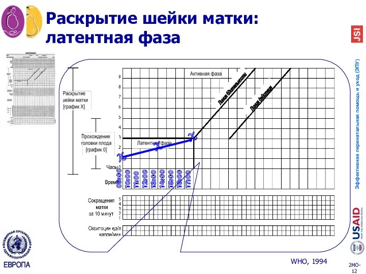 Раскрытие шейки матки: латентная фаза 09:00 10:00 11:00 12:00 13:00 14:00 15:00 16:00