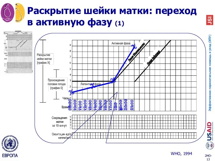 Раскрытие шейки матки: переход в активную фазу (1) 09:00 10:00