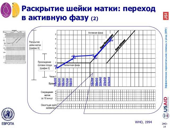 Раскрытие шейки матки: переход в активную фазу (2) 14:00 15:00