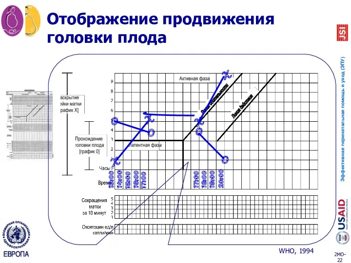 13:00 14:00 15:00 16:00 17:00 Отображение продвижения головки плода X O O Линия