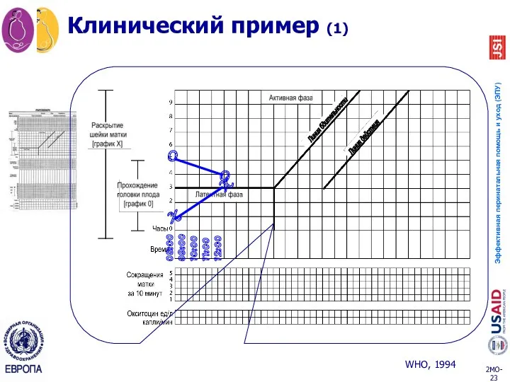 10:00 11:00 12:00 X X O Клинический пример (1) 09:00