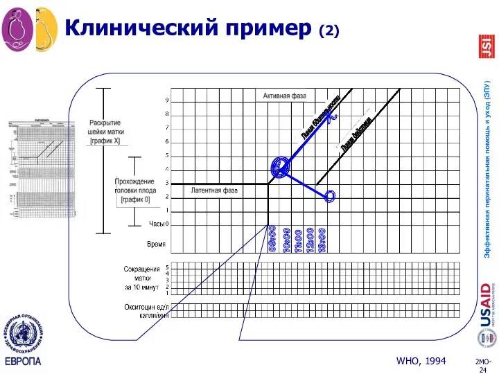 10:00 11:00 12:00 13:00 O X O Клинический пример (2)