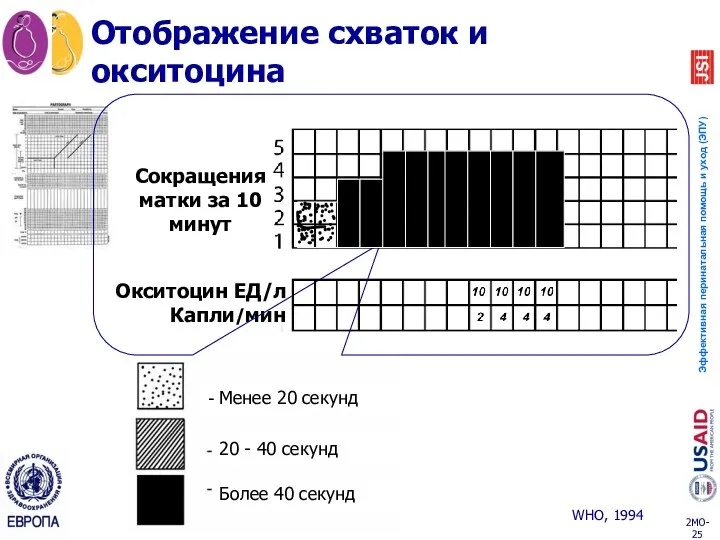 Отображение схваток и окситоцина - Менее 20 секунд 20 -