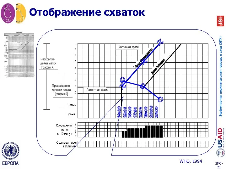 Отображение схваток 14:00 15:00 16:00 17:00 18:00 19:00 20:00 21:00 O O O