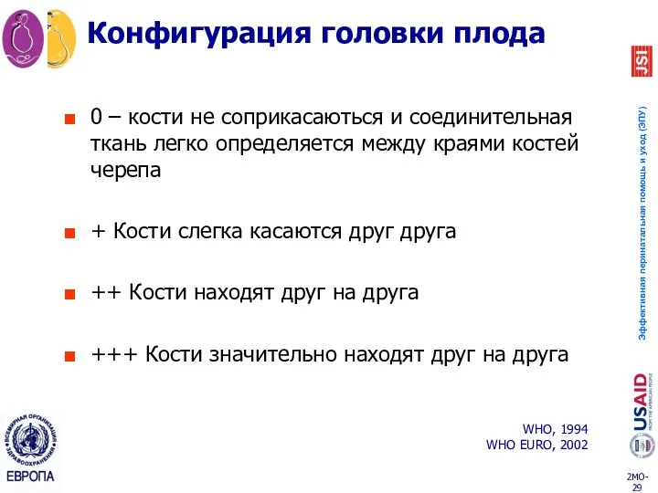 Конфигурация головки плода 0 – кости не соприкасаються и соединительная ткань легко определяется