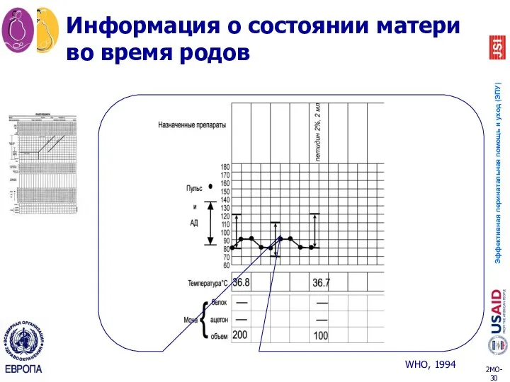 Информация о состоянии матери во время родов WHO, 1994