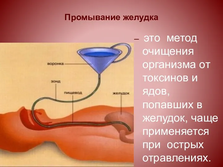 Промывание желудка – это метод очищения организма от токсинов и