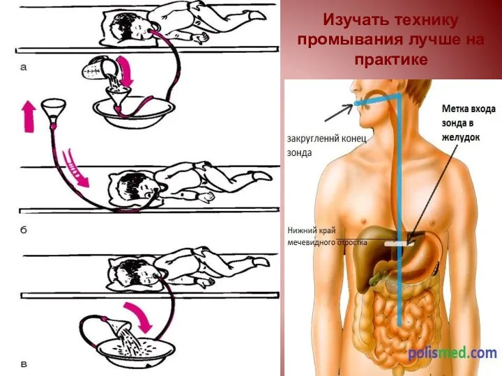 Изучать технику промывания лучше на практике