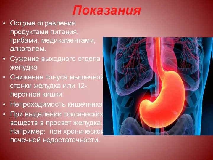 Показания Острые отравления продуктами питания, грибами, медикаментами, алкоголем. Сужение выходного