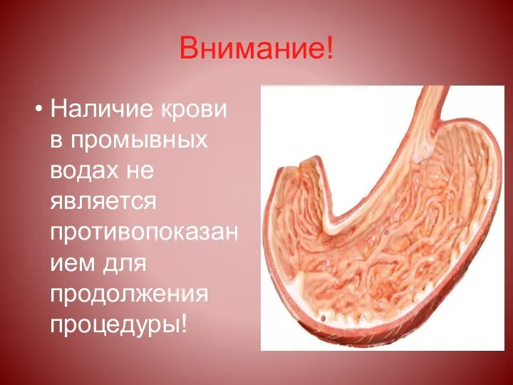 Внимание! Наличие крови в промывных водах не является противопоказанием для продолжения процедуры!