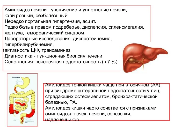 Амилоидоз печени - увеличение и уплотнение печени, край ровный, безболезнный.