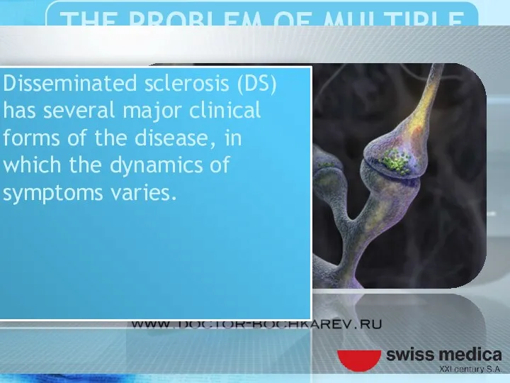 Disseminated sclerosis (DS) has several major clinical forms of the