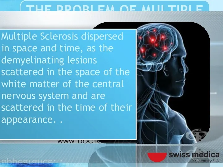 Multiple Sclerosis dispersed in space and time, as the demyelinating