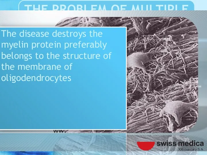 The disease destroys the myelin protein preferably belongs to the structure of the membrane of oligodendrocytes